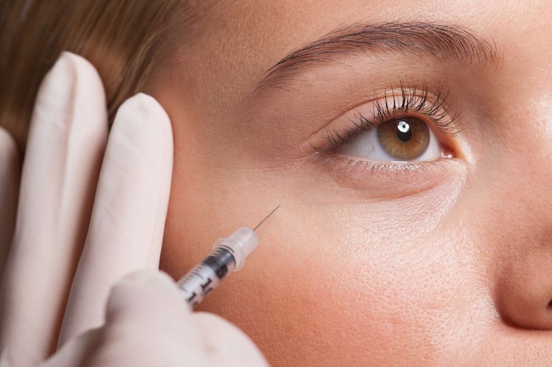Addressing the Possible Side Effects and Complications from Botox