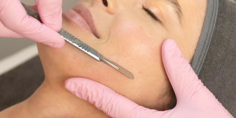The Comprehensive Benefits of Dermaplaning at SkinMedico in Chiswick